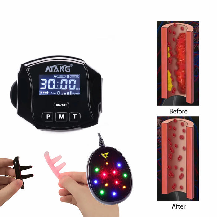 Laser therapy Treatment hyperglycemia hypertension hyperlipidemia laser therapy watch