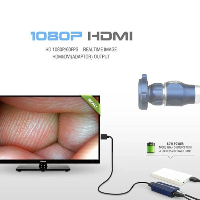 CY-FHD digital portable endoscope camera system usb hd 1080p endoscope camera