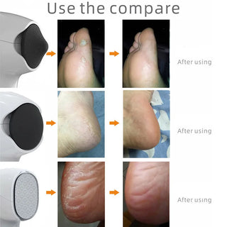 2022 NEW Pedicure Tools Nanoglass Skin Care Electric Foot File Dead Skin Callus Remover USB Foot Grinde Machine Foot Care Tool