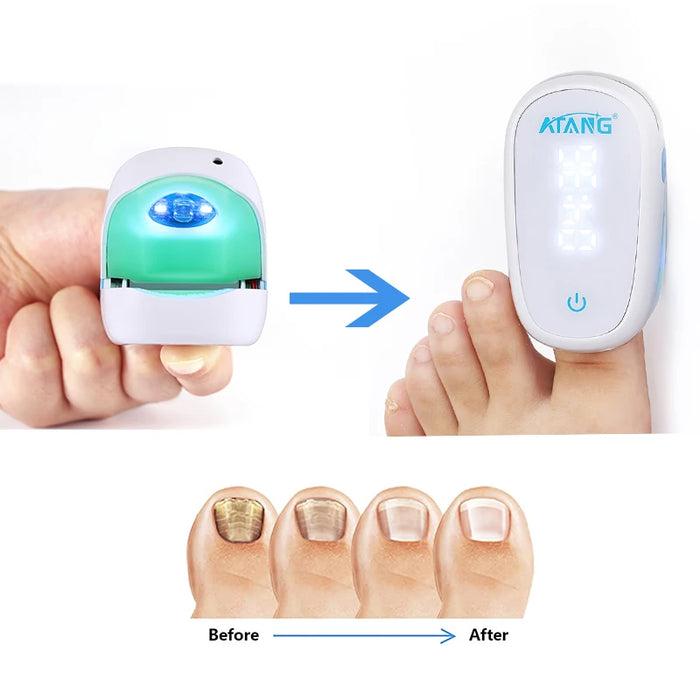 905NM Nail Fungus Laser Therapy Device Mini Painless Nail Fungus Cleaning Device Portable Anti-Slip Silicone for Foot Care Tools
