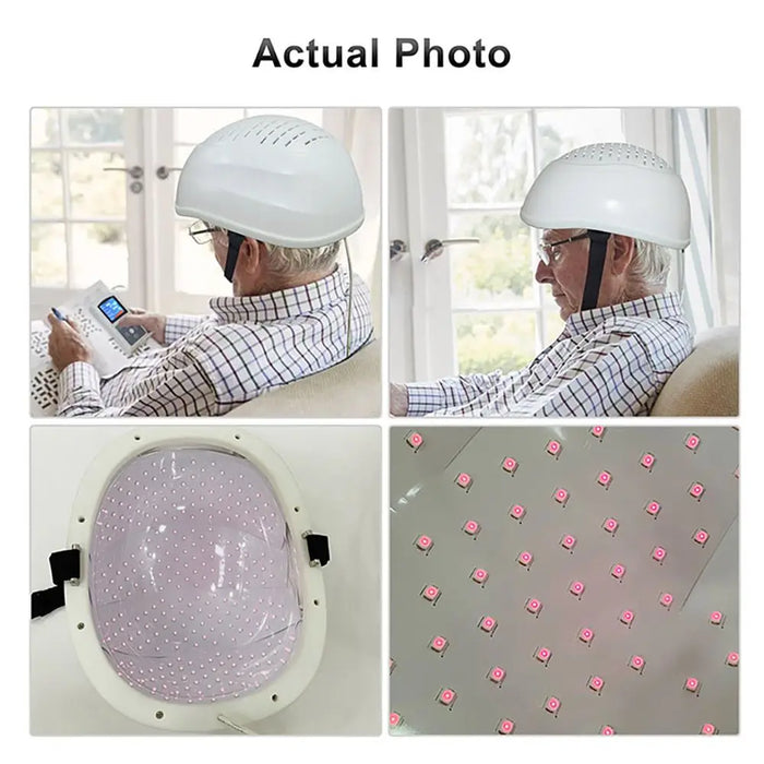 Alzheimer Tratamiento Brain Injury Helmet Alzheimer Device 40Hz LED 810nm 280 Diodes for Improving Cognition and Memory Home Use