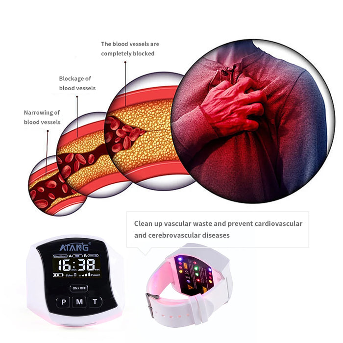 Cold Laser Therapy Watch Treatment of High Blood Pressure Diabetes Cleansing of Vascular Waste Prevents Blood Thickening