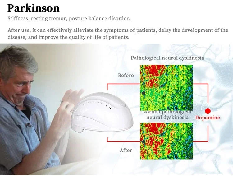 810nm Stimulate Brain Nervous System Alleviates Alzheimer's Stroke Wearable Device