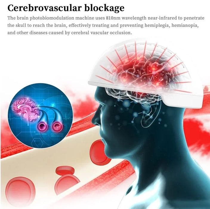 810nm Stimulate Brain Nervous System Alleviates Alzheimer's Stroke Wearable Device