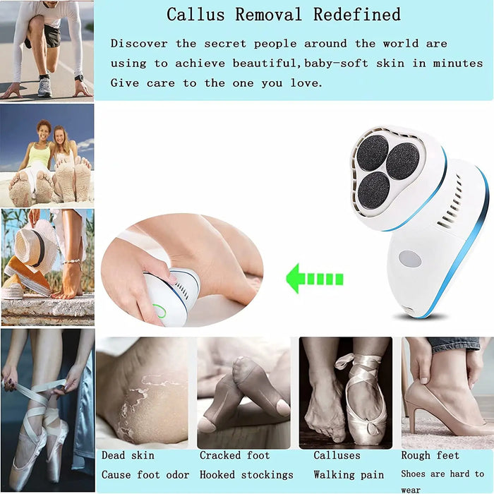 Electric Foot Rasp Electric Anti-Callus Foot Rasp with 6 Rollers and 2 Speeds - Waterproof USB Rechargeable Electric Feet Care