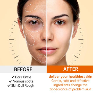 JoyPretty Vitamin C for Face Whitening Dark Spots Skin Care Set Cream Serum Cleaning Moisturizing Eye Creams Pore Skincare Kits