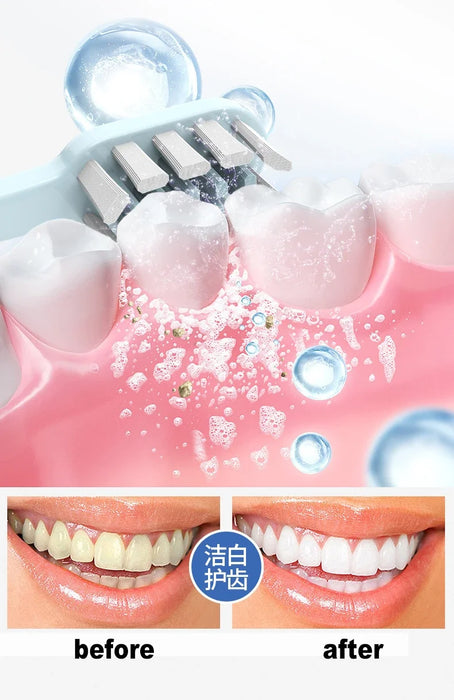 2024 New Arrival Intelligent Automatic Sonic Toothbrush Adult Charge Smart Whitening Electric Toothbrush