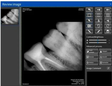 RVG Eco I/II X-rays Sensor With Holder Faster/Recycle/Durable USB X Ray Sensor Intra Oral Camera Digital RVG Image Sensor