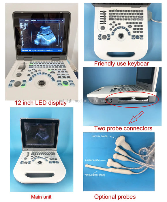 Laptop Cheap Price Veterinary Portable Vet Pregnancy Device Goats USG Medical Ultrasound Instruments for Sheep